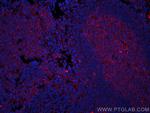 CD147 Antibody in Immunohistochemistry (PFA fixed) (IHC (PFA))