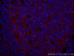 CD147 Antibody in Immunohistochemistry (PFA fixed) (IHC (PFA))