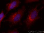 ADRM1 Antibody in Immunocytochemistry (ICC/IF)