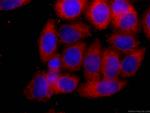 SLP76 Antibody in Immunocytochemistry (ICC/IF)