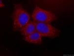 NRG1 Antibody in Immunocytochemistry (ICC/IF)