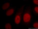SMARCA4 Antibody in Immunocytochemistry (ICC/IF)
