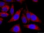 SDHA Antibody in Immunocytochemistry (ICC/IF)