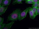 XRCC2 Antibody in Immunocytochemistry (ICC/IF)