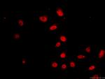 XRCC2 Antibody in Immunocytochemistry (ICC/IF)