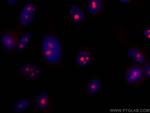 DDX54 Antibody in Immunocytochemistry (ICC/IF)