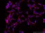 RAB3GAP1 Antibody in Immunocytochemistry (ICC/IF)