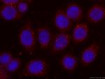 MTAP Antibody in Immunocytochemistry (ICC/IF)