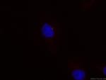 ARL13B Antibody in Immunocytochemistry (ICC/IF)