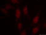 SRF Antibody in Immunocytochemistry (ICC/IF)