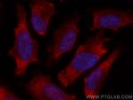 GLUT4 Antibody in Immunocytochemistry (ICC/IF)