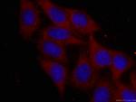 RPS6 Antibody in Immunocytochemistry (ICC/IF)