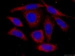 mTOR Antibody in Immunocytochemistry (ICC/IF)