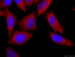 YAP1 Antibody in Immunocytochemistry (ICC/IF)