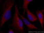 PI3 Kinase p110 Alpha Antibody in Immunocytochemistry (ICC/IF)