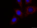 CES1 Antibody in Immunocytochemistry (ICC/IF)