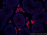 STAR Antibody in Immunohistochemistry (PFA fixed) (IHC (PFA))