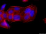 FLNA Antibody in Immunocytochemistry (ICC/IF)