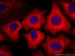 ACLY Antibody in Immunocytochemistry (ICC/IF)