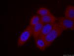 KIF20A Antibody in Immunocytochemistry (ICC/IF)