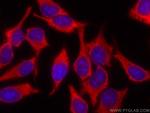 AMPD2 Antibody in Immunocytochemistry (ICC/IF)