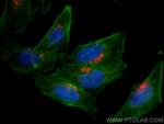 TMF1 Antibody in Immunocytochemistry (ICC/IF)