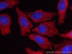 PICALM Antibody in Immunocytochemistry (ICC/IF)