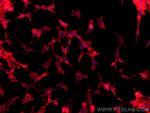 Drebrin Antibody in Immunocytochemistry (ICC/IF)