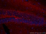 GAD1 Antibody in Immunohistochemistry (PFA fixed) (IHC (PFA))