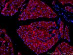 EIF3L Antibody in Immunohistochemistry (PFA fixed) (IHC (PFA))