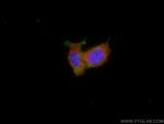 CTPS2 Antibody in Immunocytochemistry (ICC/IF)