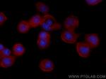 CTPS2 Antibody in Immunocytochemistry (ICC/IF)