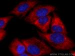 ATG16L1 Antibody in Immunocytochemistry (ICC/IF)