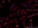 ABCE1 Antibody in Immunocytochemistry (ICC/IF)