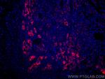 MMP7 Antibody in Immunohistochemistry (PFA fixed) (IHC (PFA))