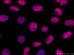 RALY Antibody in Immunocytochemistry (ICC/IF)