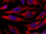 PEX14 Antibody in Immunocytochemistry (ICC/IF)