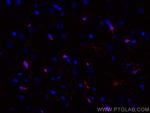 IBA1 Antibody in Immunohistochemistry (PFA fixed) (IHC (PFA))