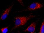 Mitofilin Antibody in Immunocytochemistry (ICC/IF)