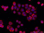 MMP9 Antibody in Immunocytochemistry (ICC/IF)