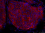 KEAP1 Antibody in Immunohistochemistry (Paraffin) (IHC (P))