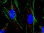 PEX14 Antibody in Immunocytochemistry (ICC/IF)