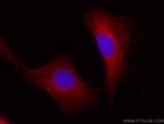 BAG3 Antibody in Immunocytochemistry (ICC/IF)