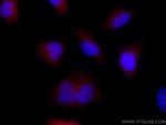 FBF1 Antibody in Immunocytochemistry (ICC/IF)