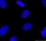 IFT81 Antibody in Immunocytochemistry (ICC/IF)