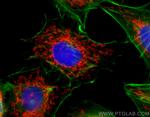 TOM20 Antibody in Immunocytochemistry (ICC/IF)