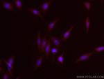 COMMD1 Antibody in Immunocytochemistry (ICC/IF)