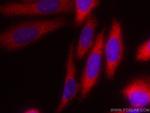 RAB3IP/Rabin8 Antibody in Immunocytochemistry (ICC/IF)