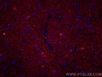 Mu Crystallin Antibody in Immunohistochemistry (Paraffin) (IHC (P))