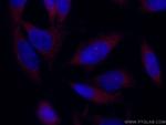 CP110 Antibody in Immunocytochemistry (ICC/IF)